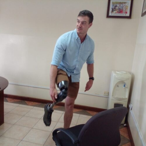 Availing Affordable Prosthetic Legs